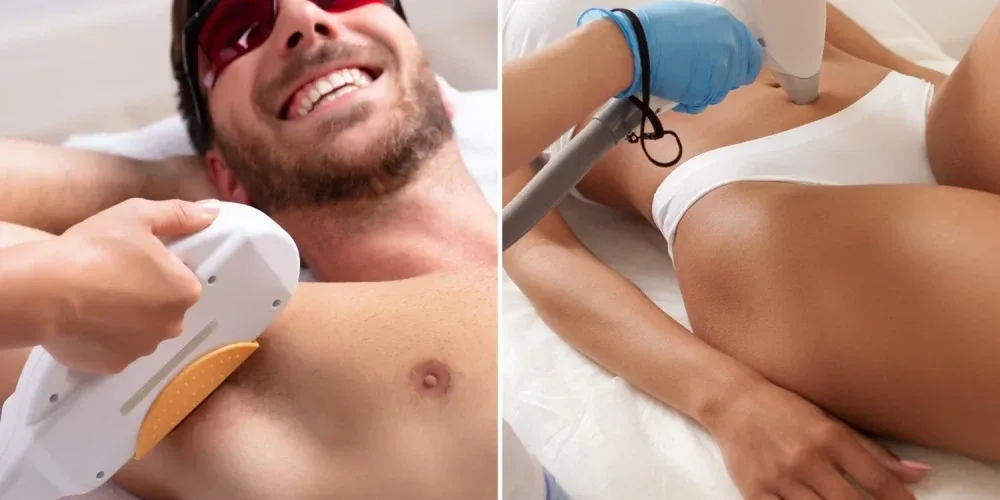 Complete Guide to Laser Hair Removal in Lahore | The Skin Care Studio