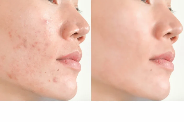 7-Step 3D Hydra Facial