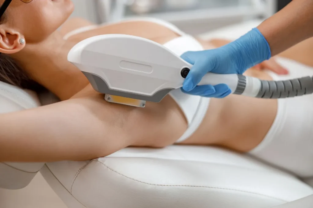 Underarm Laser Hair Removal