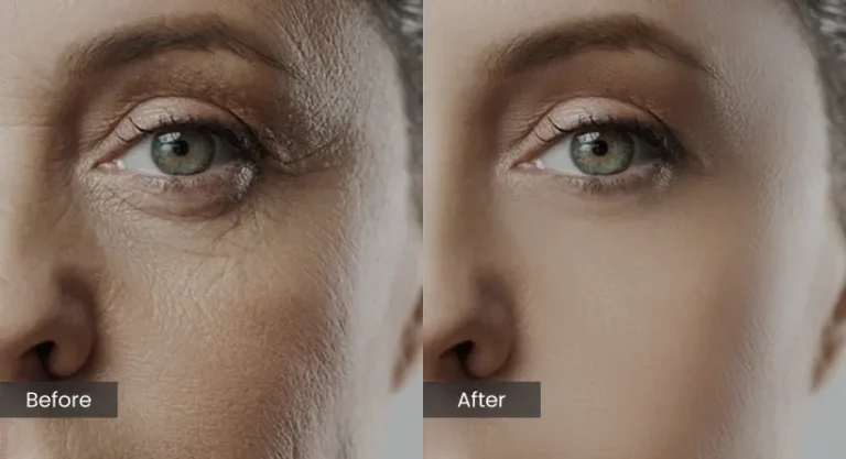 Oxygen Facial Treatment