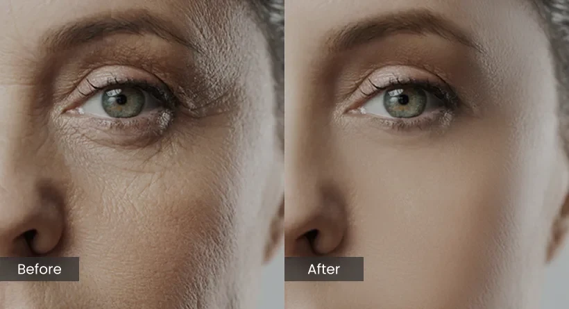 Oxygen Facial Treatment