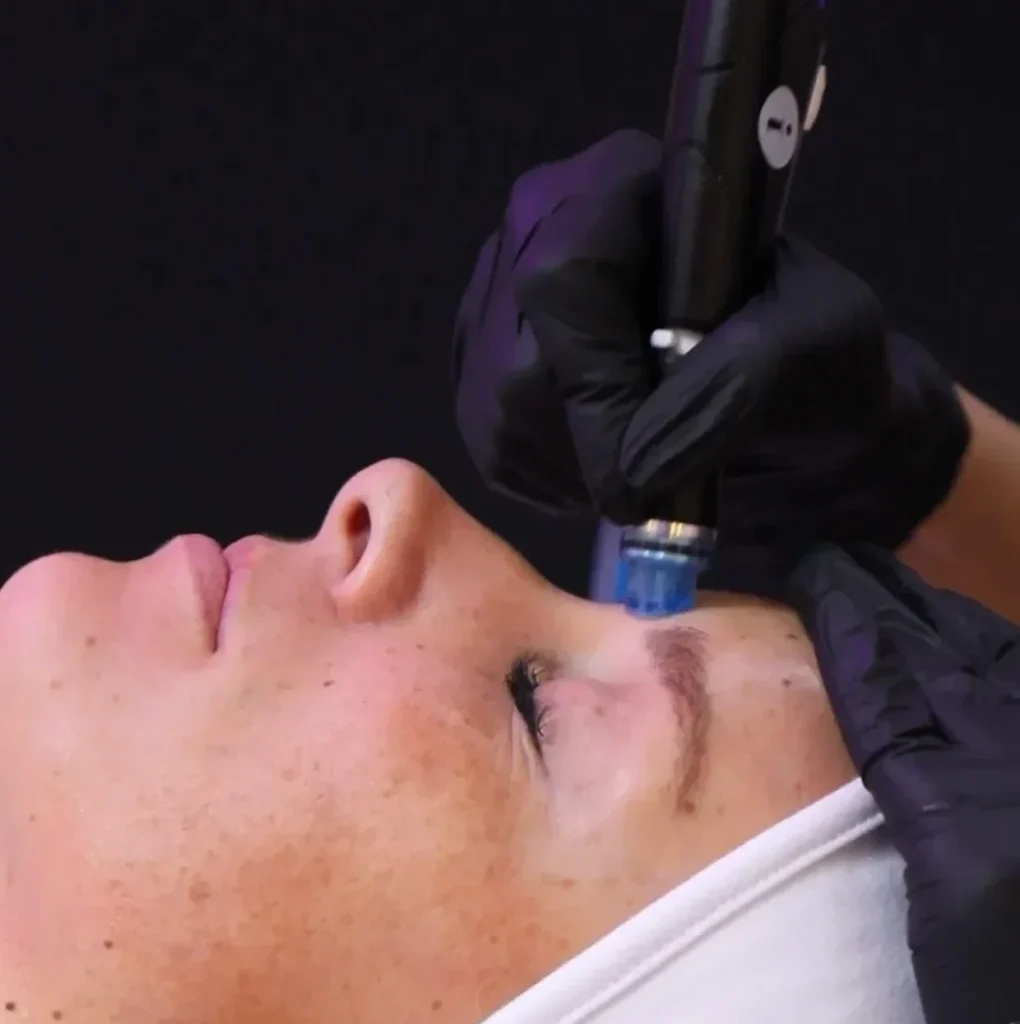 Facials Treatments