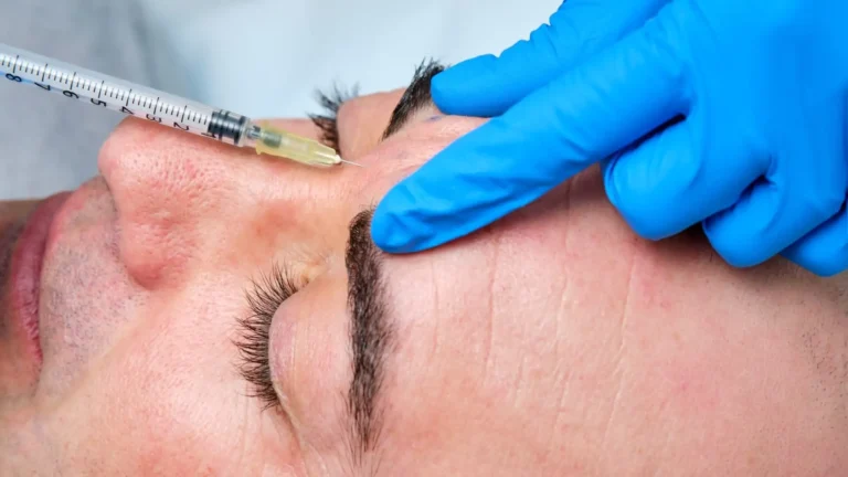 Brow/Forehead Lift
