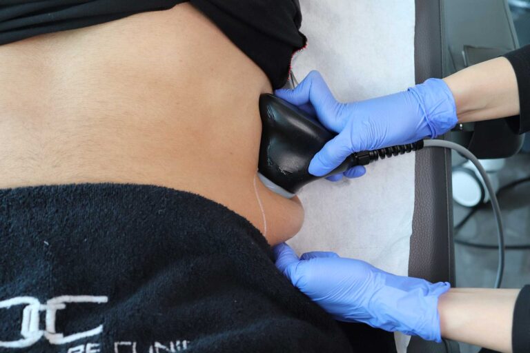 Love Handles Reduction Treatment