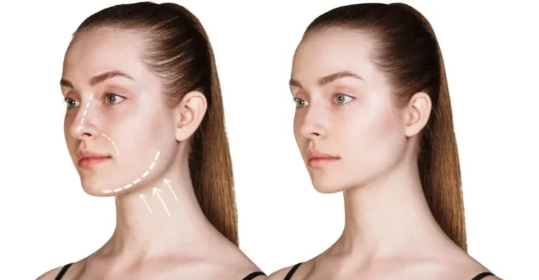 Face Lift for Women