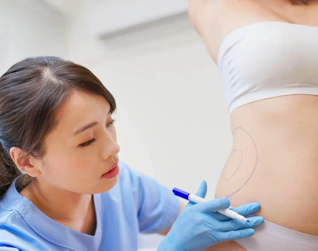 Love Handles Reduction Treatment
