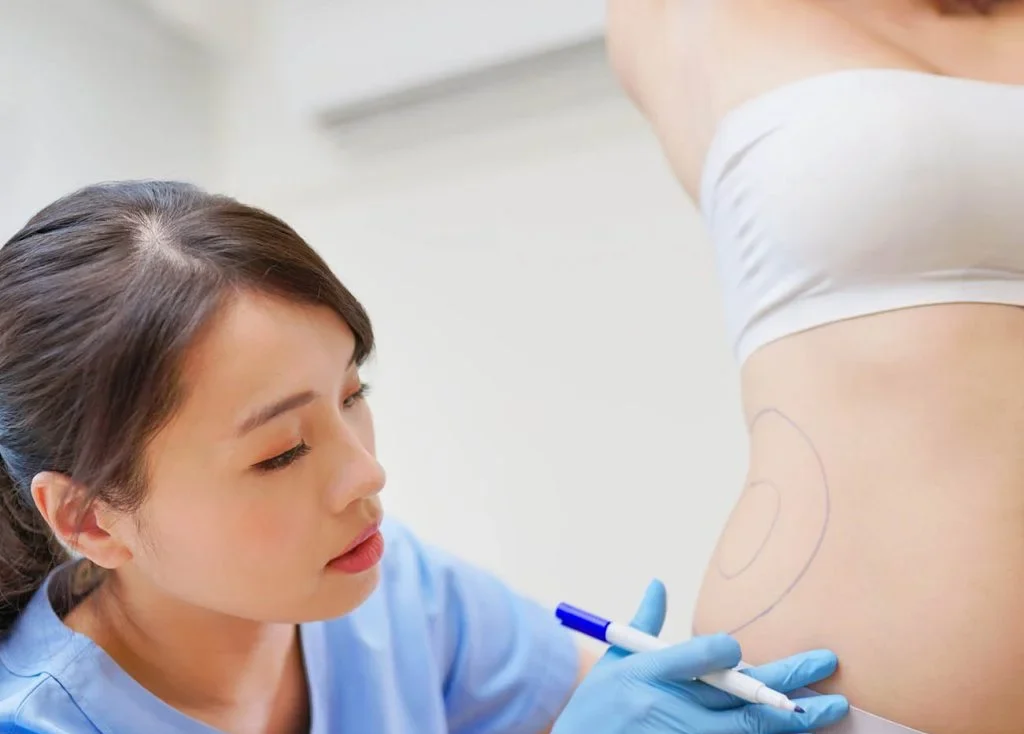 Belly Fat Reduction