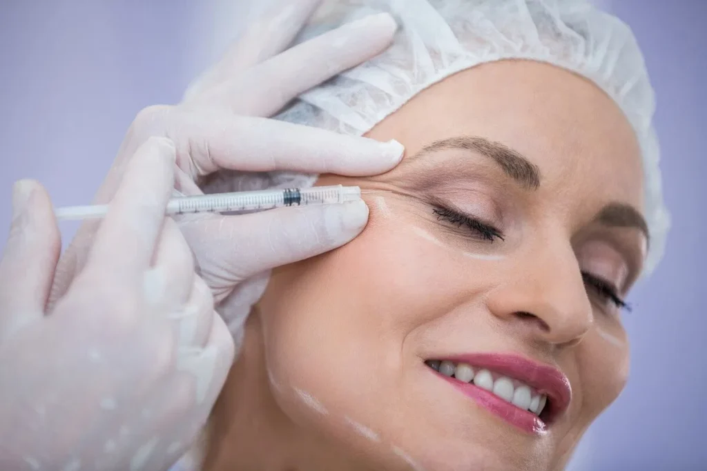 Brow/Forehead Lift
