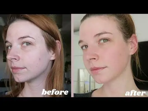 7-Step 3D Hydra Facial