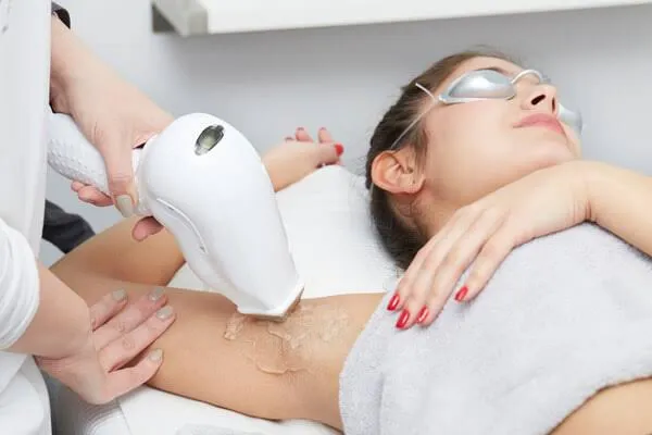 Laser Removal