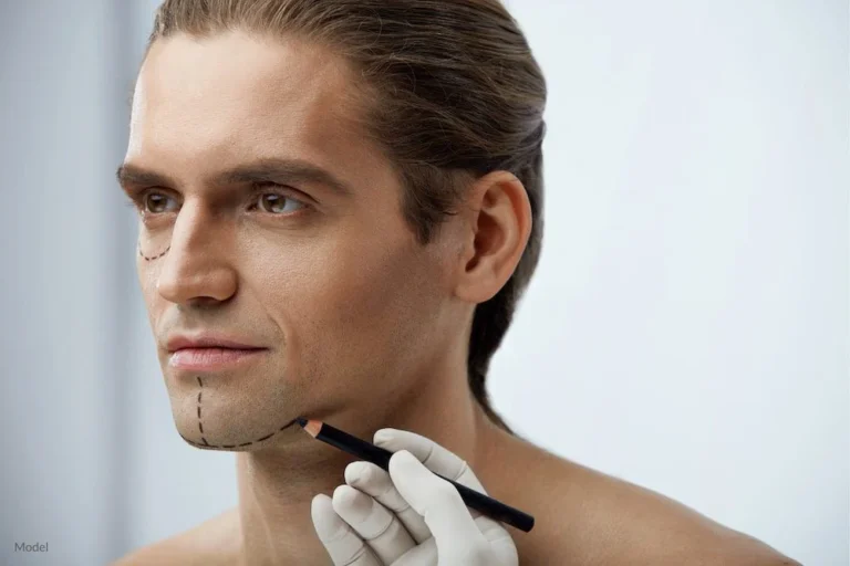 Neck Lift for Men