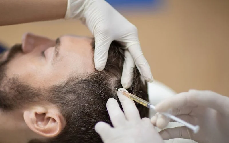PRP Hair Treatment