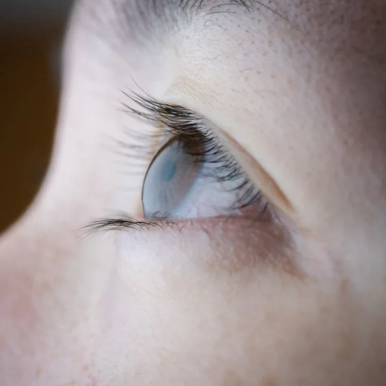 Sagging Eyelids Treatment in Lahore
