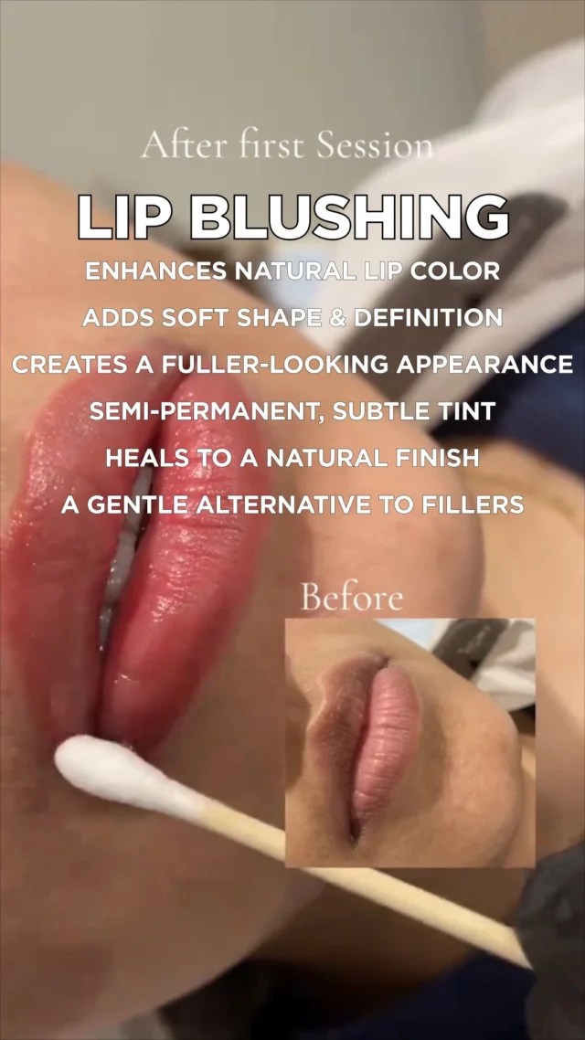 Lip blushing is perfect for anyone who wants naturally tinted lips without the need for daily lipstick. The result heals soft, subtle, and beautifully natural.

📞 0302 0010492
Visit Us
📍 Near Johar Town, PIA Road, PIA Society, 40C Block, Lahore
.
#1212Surprise
#LaserHairRemoval #SmoothSkinJourney #LaserTreatment #SkinStudioPK #LahoreSkinCare #AestheticClinic #ConfidenceInYourSkin #GlowWithCare #SmoothSkinGoals #SkinCareThatWorks #FeelFlawless #LahoreAesthetics #LahoreBeauty #PermanentHairReduction #ByeByeWaxing #NoMoreShaving #SilkySmoothSkin #LaserExperts #HydraFacialLahore #PRPLahore #AestheticExperts #SkincareLahore #BeautyClinicLahore #SkinGlowUp