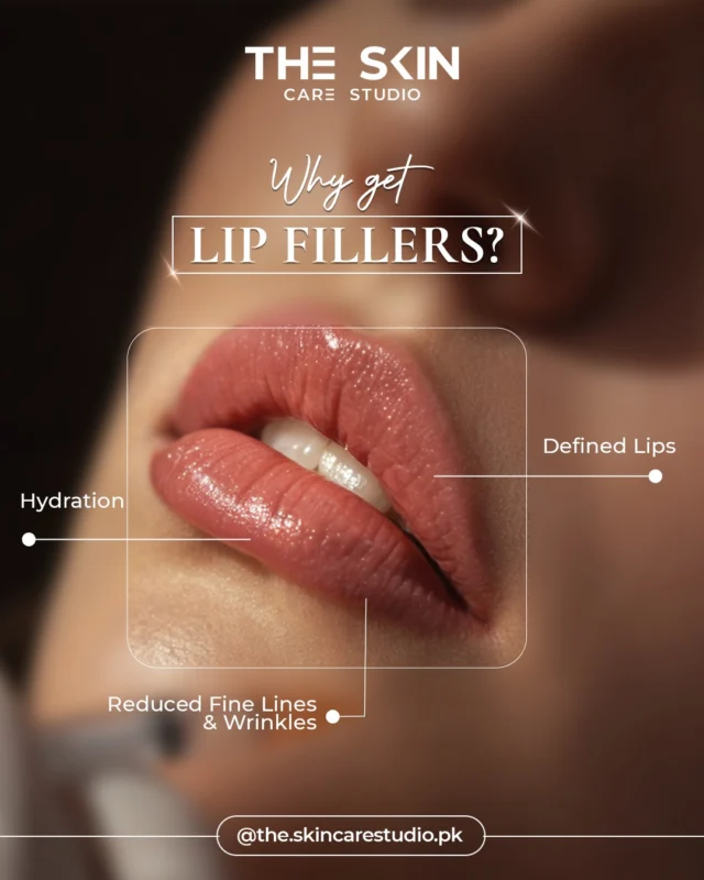 Soft volume. Natural definition. Lasting hydration. Lip fillers enhance your lips while keeping them beautifully you. 

Book your appointment today!
📞 0302 0010492
Visit Us
📍 Near Johar Town, PIA Road, PIA Society, 40C Block, Lahore
.
#LaserHairRemoval #SmoothSkinJourney #LaserTreatment #SkinStudioPK #LahoreSkinCare #AestheticClinic #ConfidenceInYourSkin #GlowWithCare #SmoothSkinGoals #SkinCareThatWorks #FeelFlawless #LahoreAesthetics #LahoreBeauty #PermanentHairReduction #ByeByeWaxing #NoMoreShaving #SilkySmoothSkin #LaserExperts #HydraFacialLahore #PRPLahore #AestheticExperts #SkincareLahore #BeautyClinicLahore #SkinGlow