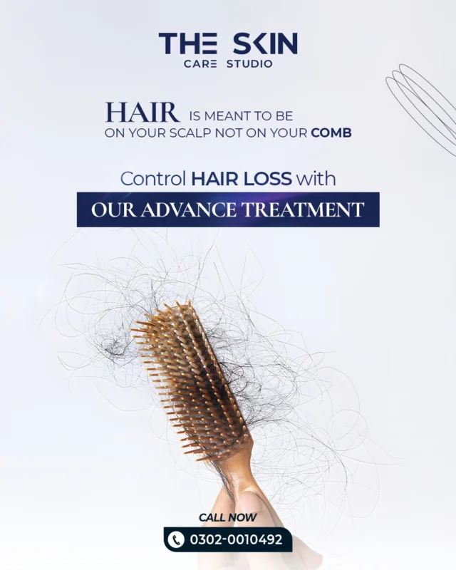 Seeing more hair on your brush lately? That’s your sign. Hair thinning often starts gradually stress, diet, hormones, and environmental damage all play a role. Without proper treatment, follicles can shrink, leading to visible thinning and loss of density.

The sooner you treat it, the better the recovery. Schedule your consultation today.

Book your appointment today!
📞 0302 0010492
Visit Us
📍 Near Johar Town, PIA Road, PIA Society, 40C Block, Lahore
.
#LaserHairRemoval #SmoothSkinJourney #LaserTreatment #SkinStudioPK #LahoreSkinCare #AestheticClinic #ConfidenceInYourSkin #GlowWithCare #SmoothSkinGoals #SkinCareThatWorks #FeelFlawless #LahoreAesthetics #LahoreBeauty #PermanentHairReduction #ByeByeWaxing #NoMoreShaving #SilkySmoothSkin #LaserExperts #HydraFacialLahore #PRPLahore #AestheticExperts #SkincareLahore #BeautyClinicLahore #SkinGlow