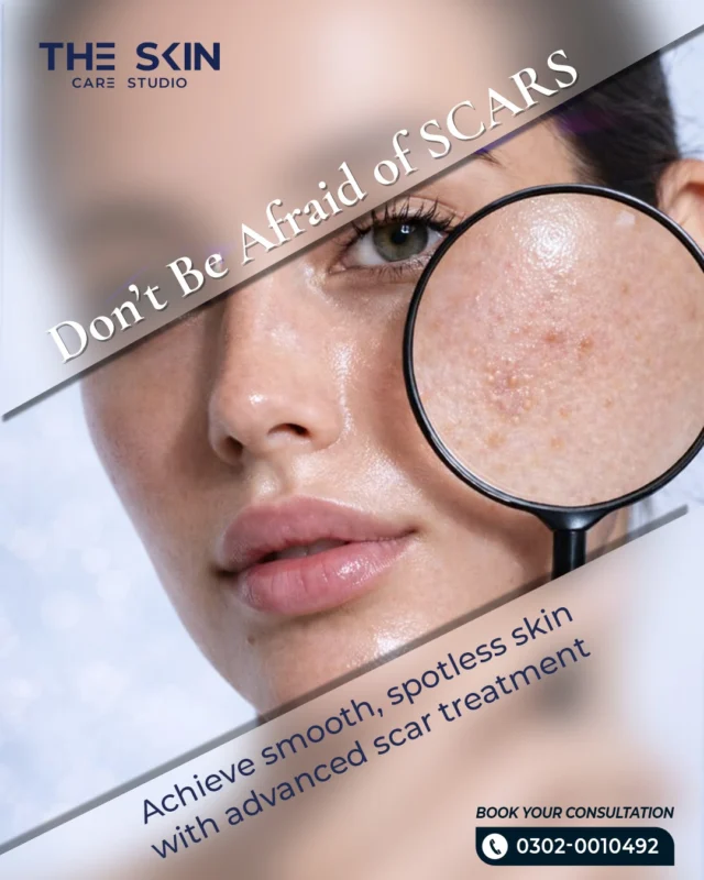 Scars don’t define your skin, confidence does ✨ Achieve smoother, clearer skin with our advanced scar treatments.

Book your appointment today!
📞 0302 0010492
Visit Us
📍 Near Johar Town, PIA Road, PIA Society, 40C Block, Lahore