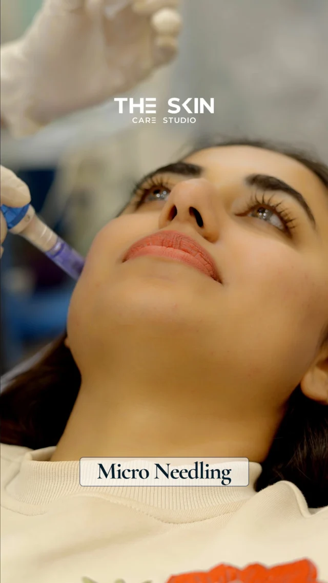 Glow deeper than the surface ✨

Say hello to smoother, firmer, radiant skin with Microneedling. Reduce acne scars, fine lines & dullness, all in one go 🔥

It’s not just skincare… It’s a skin transformation 😍

Book your appointment today!
📞 0302 0010492
Visit Us
📍 Near Johar Town, PIA Road, PIA Society, 40C Block, Lahore